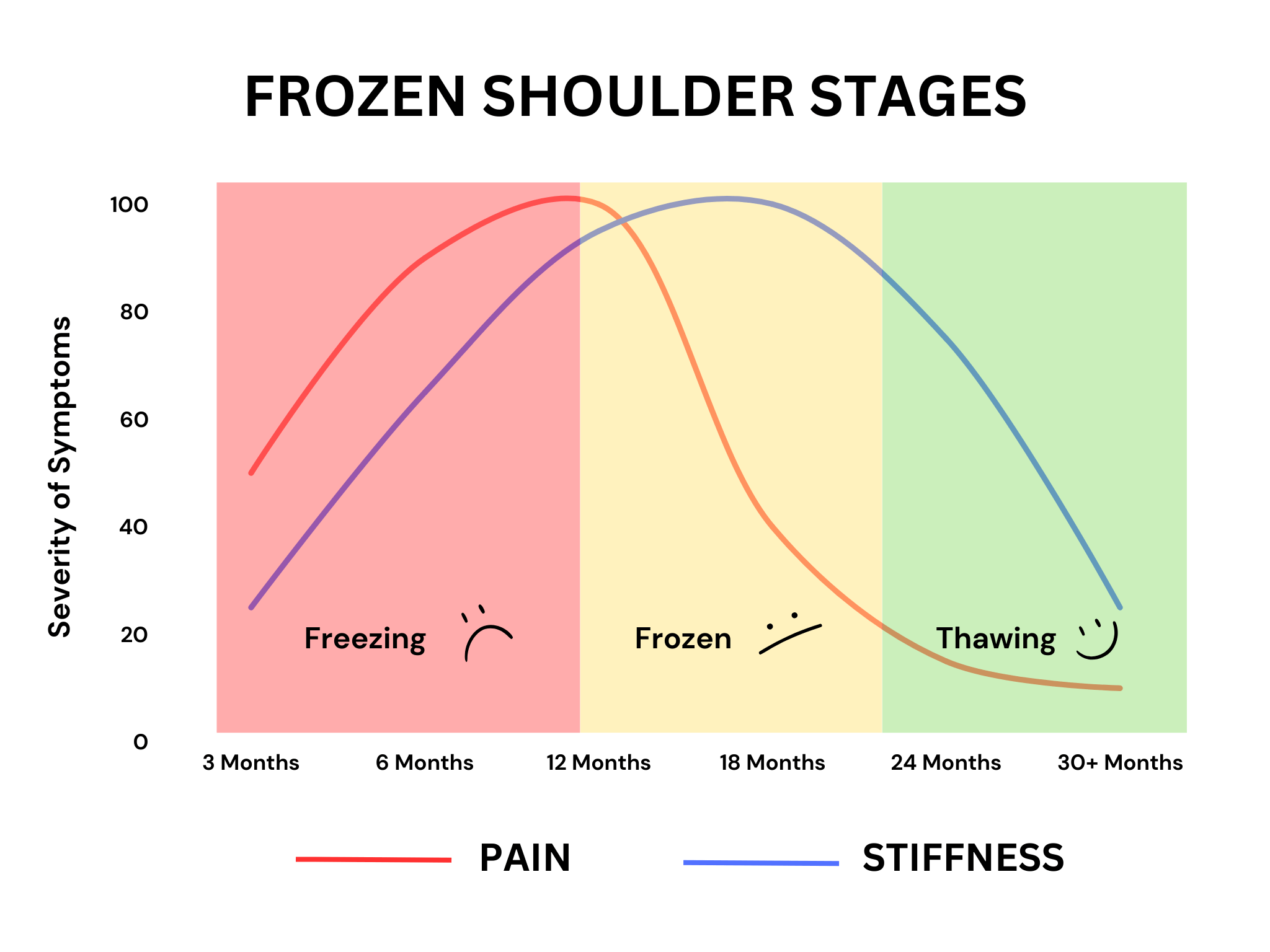 Frozen shoulder stages – pain vs stiffness timeline