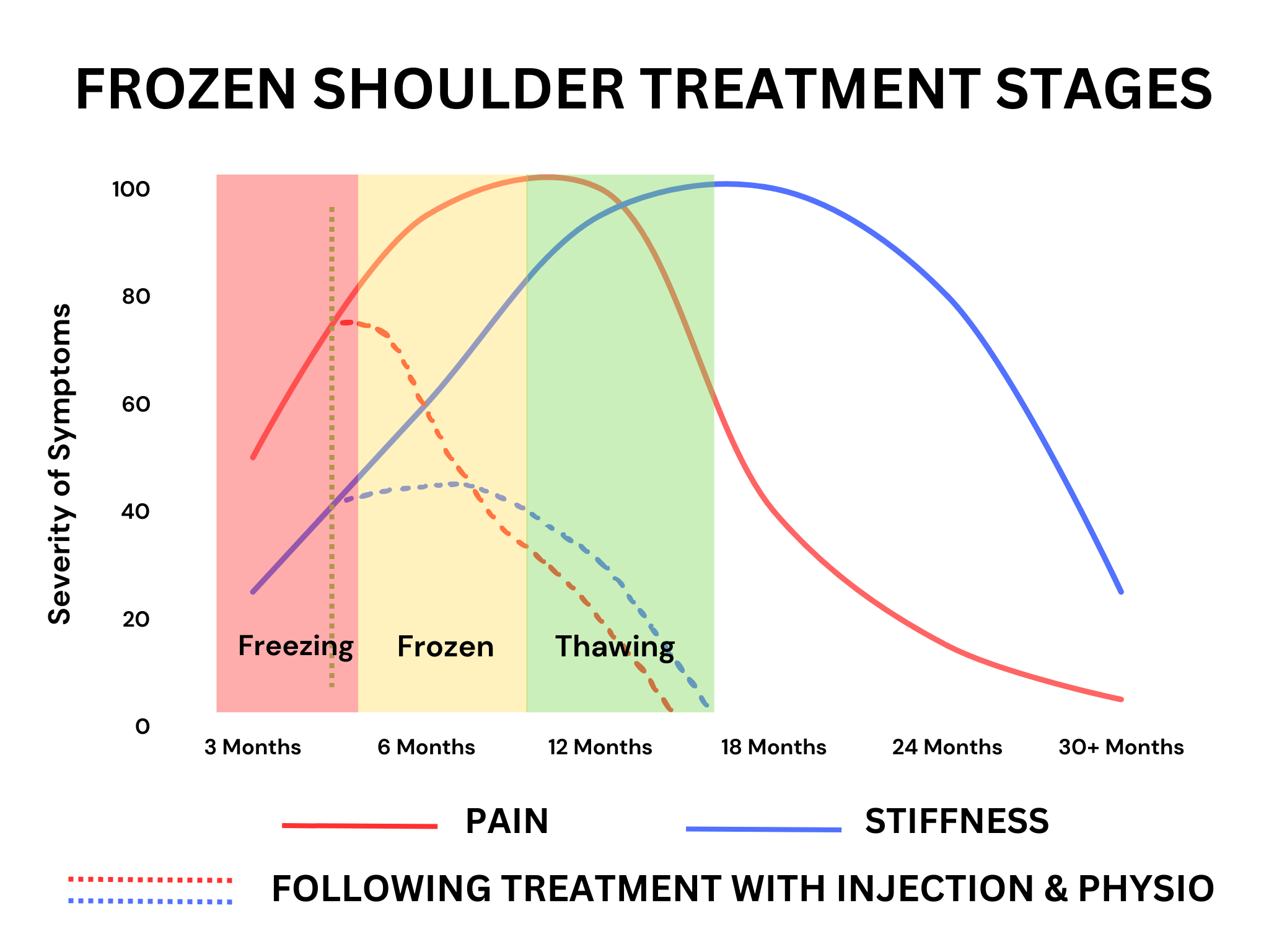 frozen-shoulder-cortisone-injection-symptom-improvement-graph