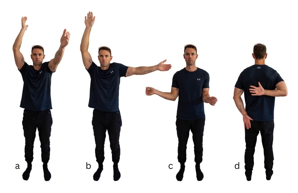 Frozen shoulder progression – increasing stiffness and loss of movement Progressive loss of shoulder movement as frozen shoulder stiffness increases over time