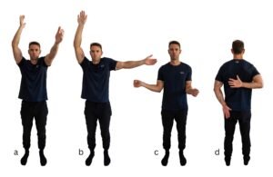 Progressive loss of shoulder movement as frozen shoulder stiffness increases over time