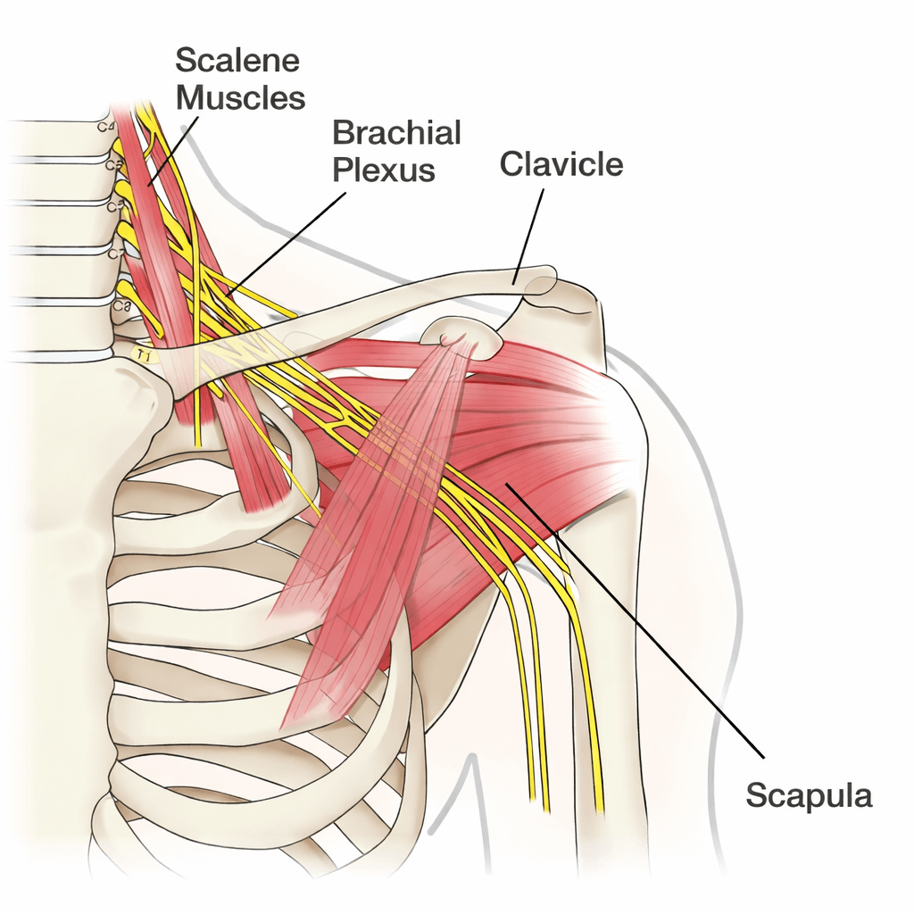 Neck and shoulder pain anatomy diagram Anatomy diagram showing nerves and muscles involved in neck and shoulder pain, including the brachial plexus and scalene muscles